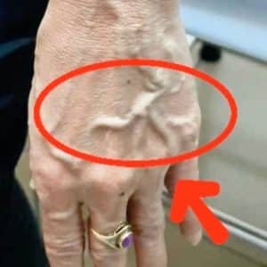 Visible Veins Don't Mean Poor Circulation — Here's What They Actually Signal