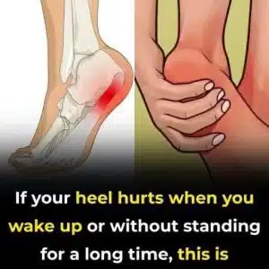 7 Exercises Physical Therapists Recommend to Beat Plantar Fasciitis and Stop Heel Pain for Good