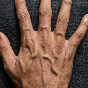 If Your Hand Veins Are More Visible Than They Used To Be, Here Is What Your Body Is Actually Telling You