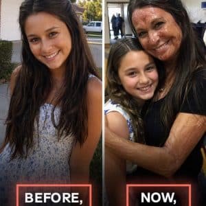 My Daughter Begged Me to Stop Coming to Her School Because of My Scars — Then a Stranger Walked Into the Auditorium and Told Everyone What I Had Been Hiding for Twenty Years