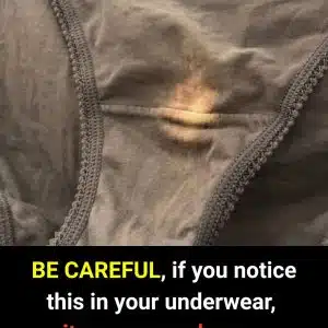 What Underwear Discoloration Really Means for Your Health