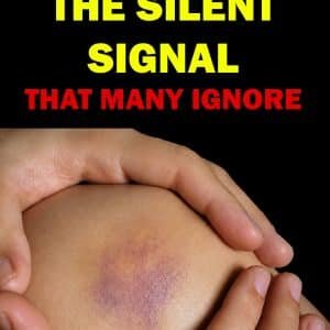 Leukemia Warning Signs Most People Mistake for Tiredness or the Flu