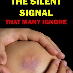 Leukemia Warning Signs Most People Mistake for Tiredness or the Flu