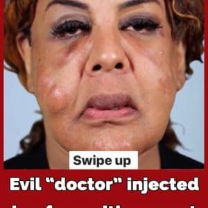 She Was Injected With Cement and Superglue — Here's How Rajee Narinesingh Rebuilt Her Life