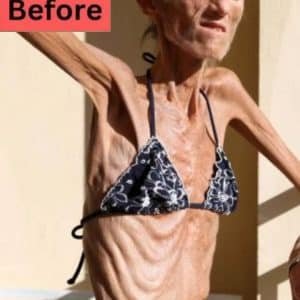 She Was Called "The World's Thinnest Woman" — This Is What She Wants You to Know