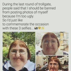 Melissa Blake: The Writer Who Responded to Online Bullying With a Year of Selfies